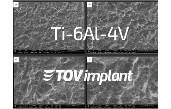 L'Utilisation du Titane Grade 5 pour la Fabrication des Implants Dentaires